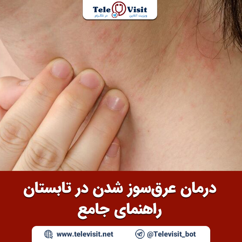 درمان-عرق-سوز-شدن-در-تابستان-راهنمای-جامع-تله-ویزیت